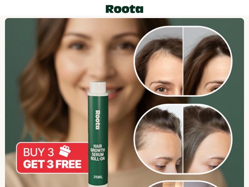 Roota Hair Growth Serum SS - US/CA/UK/FR/AU/NZ