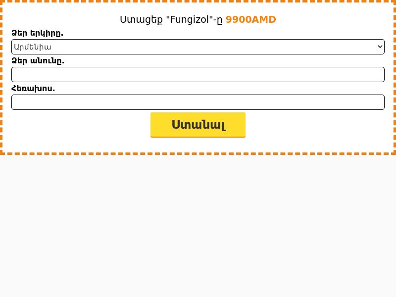 Fungizol 30 ml 9900 AMD - ANTIFUNGAL CREAM