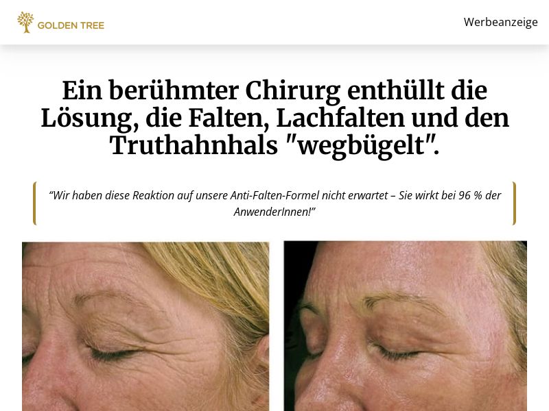 ! NEW OFFER - Ageless Anti Aging Cream [DE] (Social,Banner,Native,Push,SEO,Search,Brand Bidding) - CPA