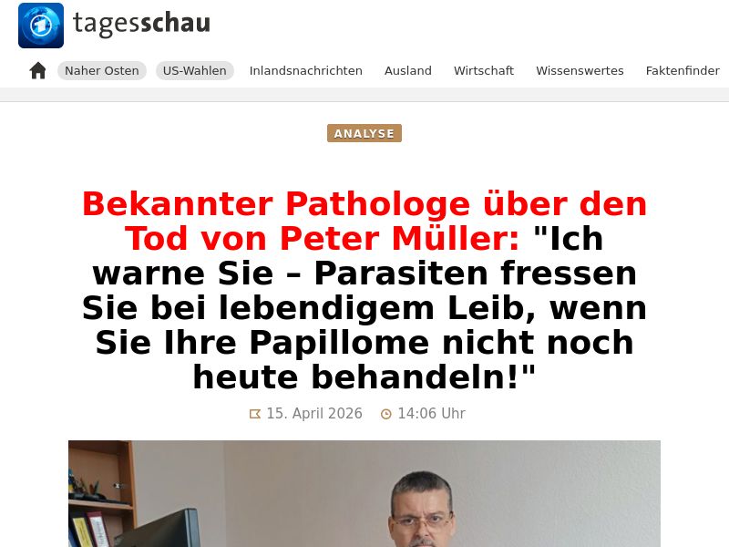 Parazicid EU - ANTI-PARASITE CAPS