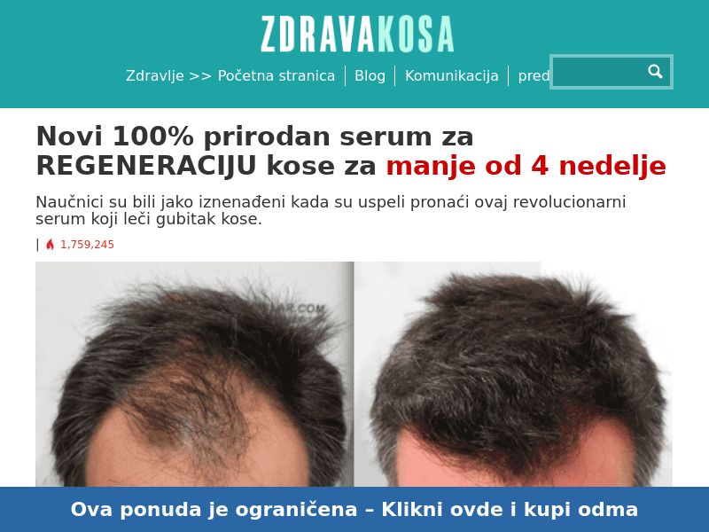 RegenoFit shampoo 2000 RSN - hair loss remedy